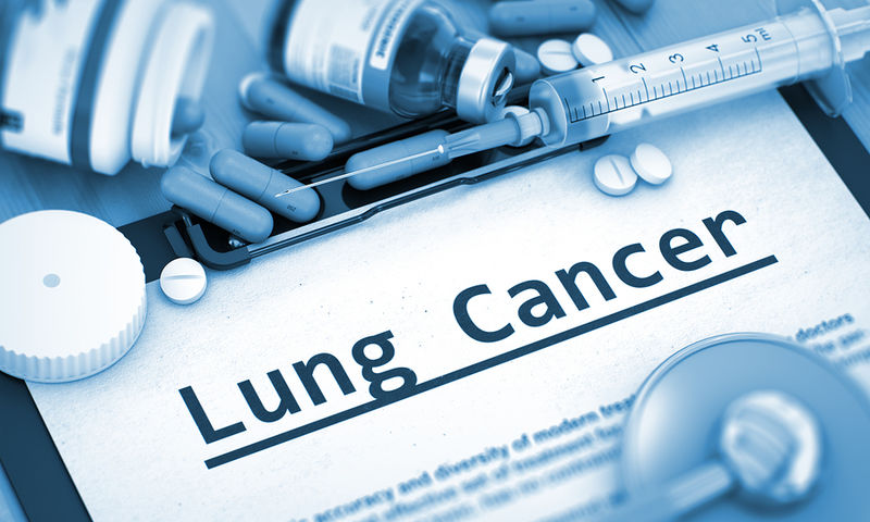 Καρκίνος πνεύμονα: Ποιες θεραπείες αυξάνουν το χρόνο επιβίωσης