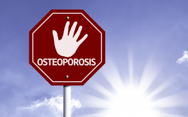Νέες οδηγίες για τη διάγνωση της Οστεοπόρωσης από το ΚΕΣΥ! Τι αλλάζει για ασθενείς-γιατρούς